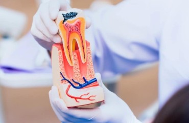 Endodontistry